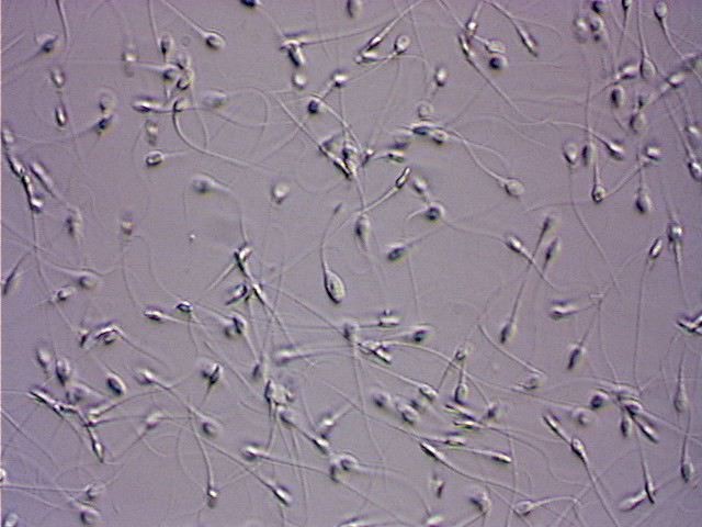     Sperm preparation