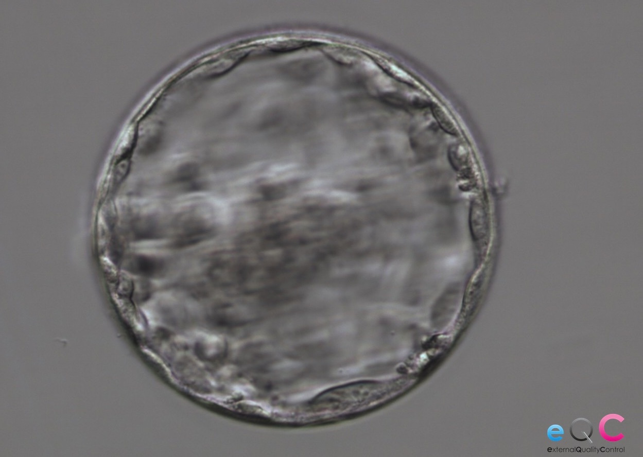     Expanded blastocyst